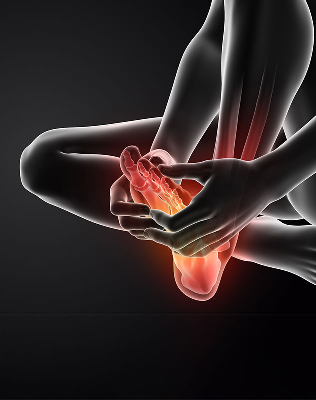 person holding their foot, foot is colored red to show pain